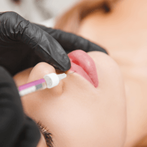 Escultura Labial con Ácido Hialurónico