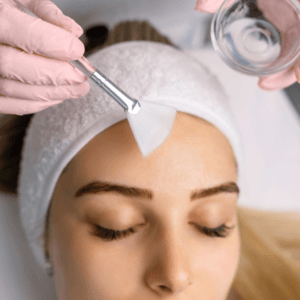 Peeling Retinol